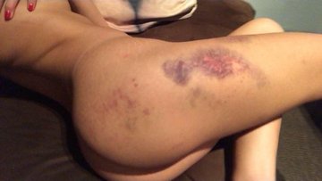 Порнозвезда пожаловалась на избившего ее порноактера.