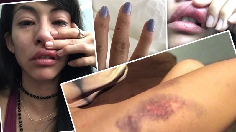 Порнозвезда пожаловалась на избившего ее порноактера.